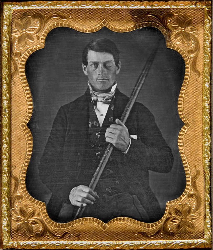 Daguerreotype portrait of Phineas Gage holding the tamping iron that passed through his skull